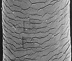 Hair Follicles