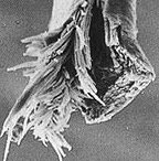 Hair Shaft Damage